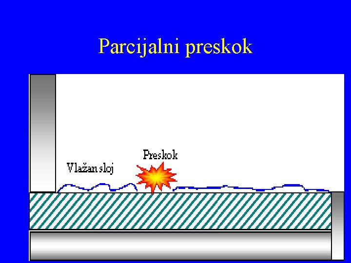 Parcijalni preskok 