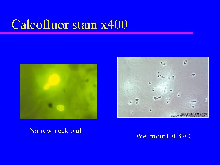 Calcofluor stain x 400 Narrow-neck bud Wet mount at 37 C 