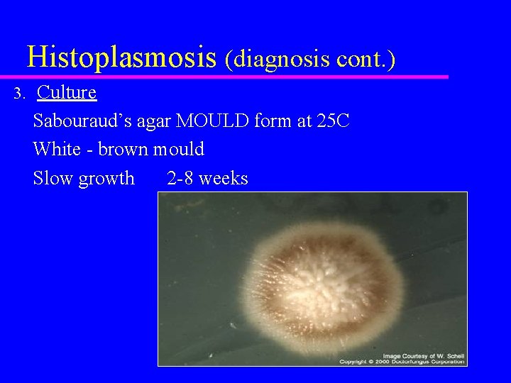 Histoplasmosis (diagnosis cont. ) 3. Culture Sabouraud’s agar MOULD form at 25 C White