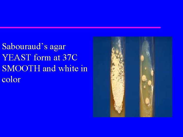 Sabouraud’s agar YEAST form at 37 C SMOOTH and white in color 