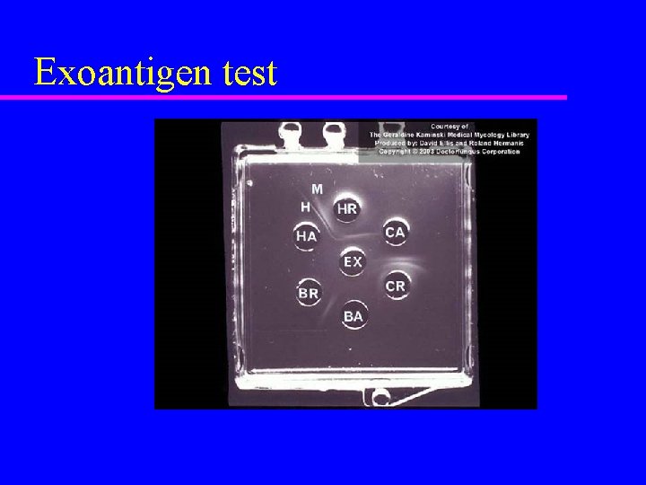 Exoantigen test 