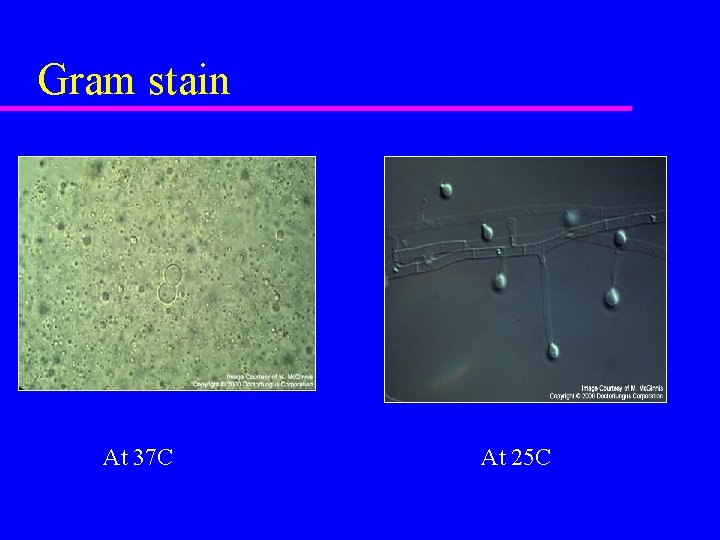 Gram stain At 37 C At 25 C 