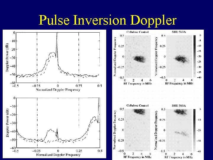 Pulse Inversion Doppler 