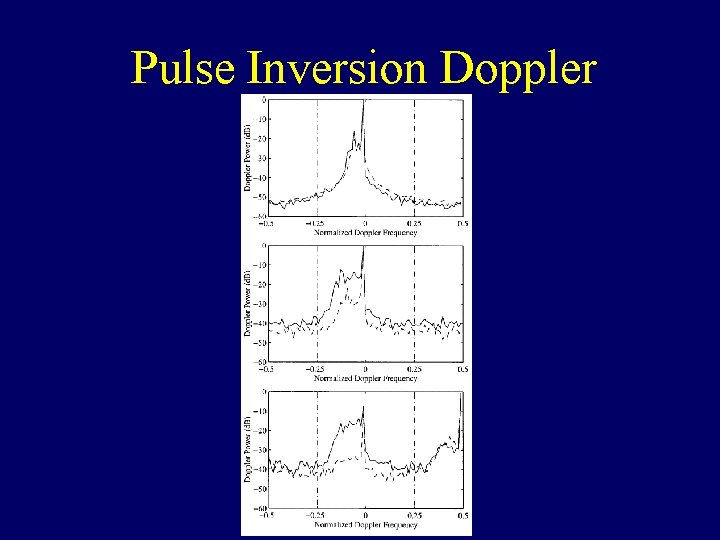 Pulse Inversion Doppler 
