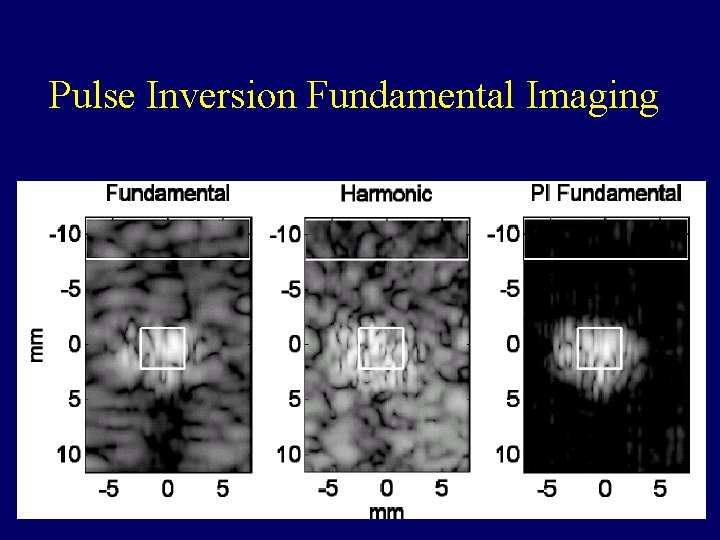 Pulse Inversion Fundamental Imaging 