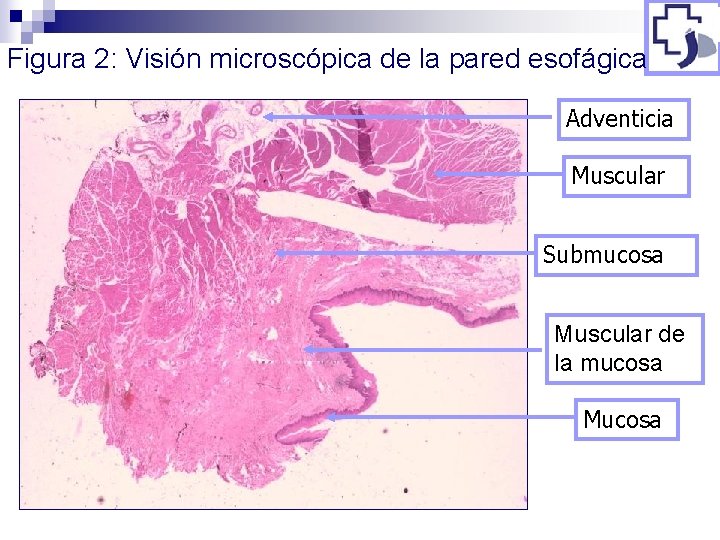 Figura 2: Visión microscópica de la pared esofágica Adventicia Muscular Submucosa Muscular de la