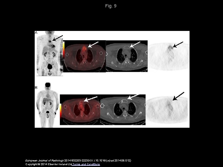 Fig. 9 European Journal of Radiology 2014 832203 -2223 DOI: (10. 1016/j. ejrad. 2014.