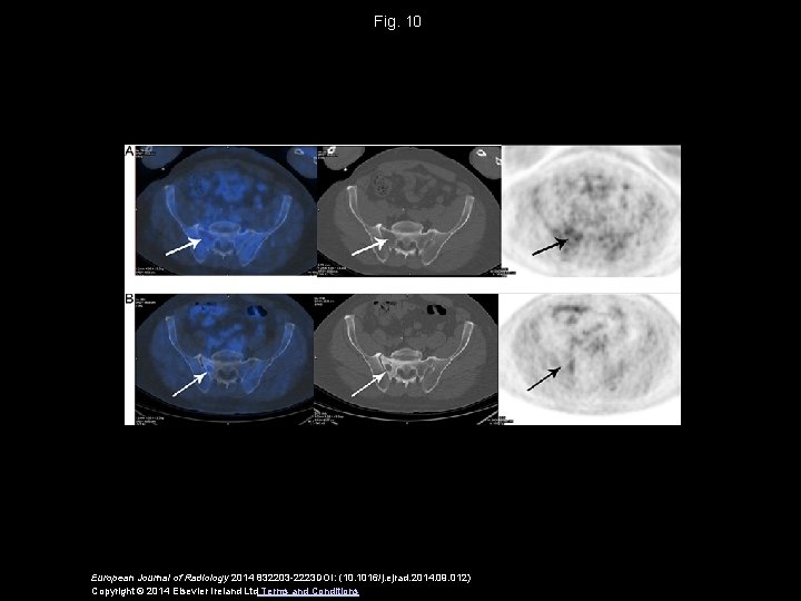 Fig. 10 European Journal of Radiology 2014 832203 -2223 DOI: (10. 1016/j. ejrad. 2014.