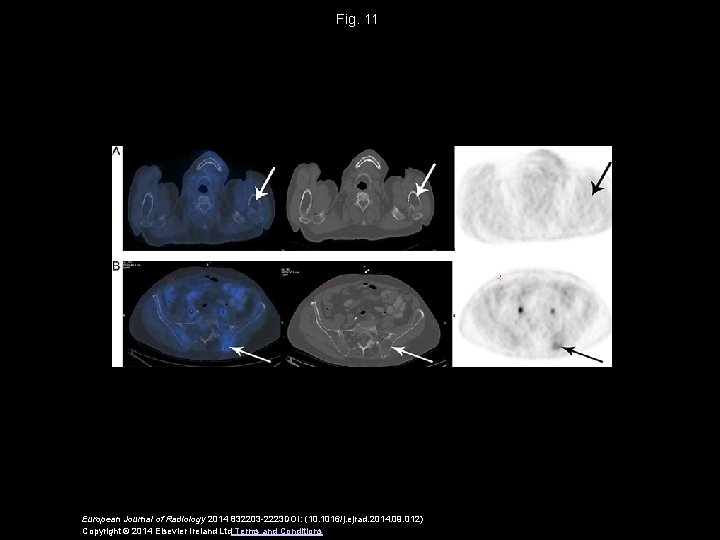 Fig. 11 European Journal of Radiology 2014 832203 -2223 DOI: (10. 1016/j. ejrad. 2014.