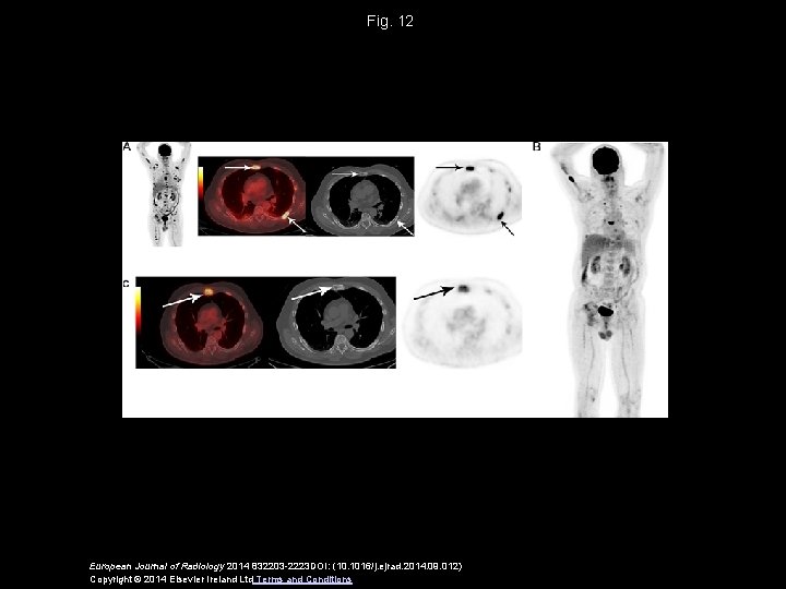 Fig. 12 European Journal of Radiology 2014 832203 -2223 DOI: (10. 1016/j. ejrad. 2014.