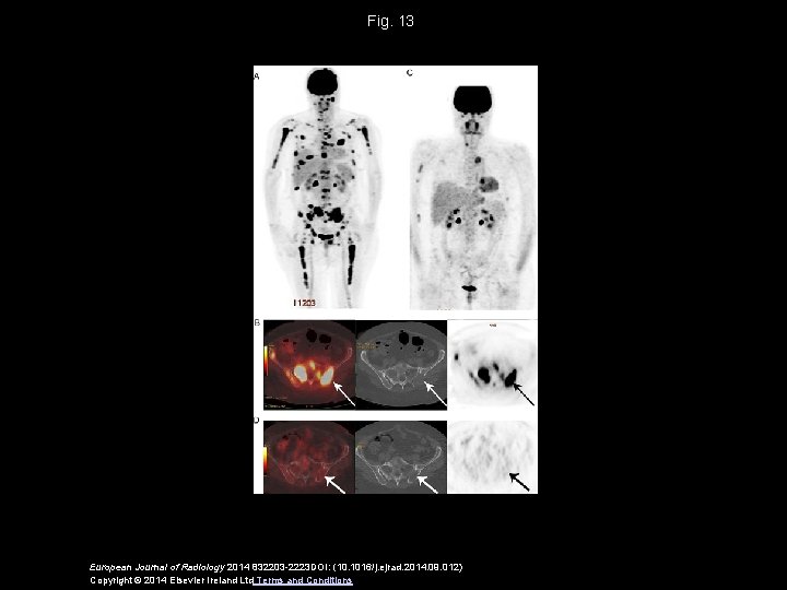 Fig. 13 European Journal of Radiology 2014 832203 -2223 DOI: (10. 1016/j. ejrad. 2014.