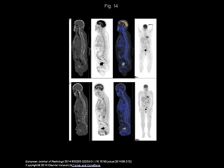 Fig. 14 European Journal of Radiology 2014 832203 -2223 DOI: (10. 1016/j. ejrad. 2014.