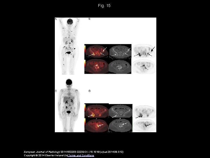 Fig. 15 European Journal of Radiology 2014 832203 -2223 DOI: (10. 1016/j. ejrad. 2014.