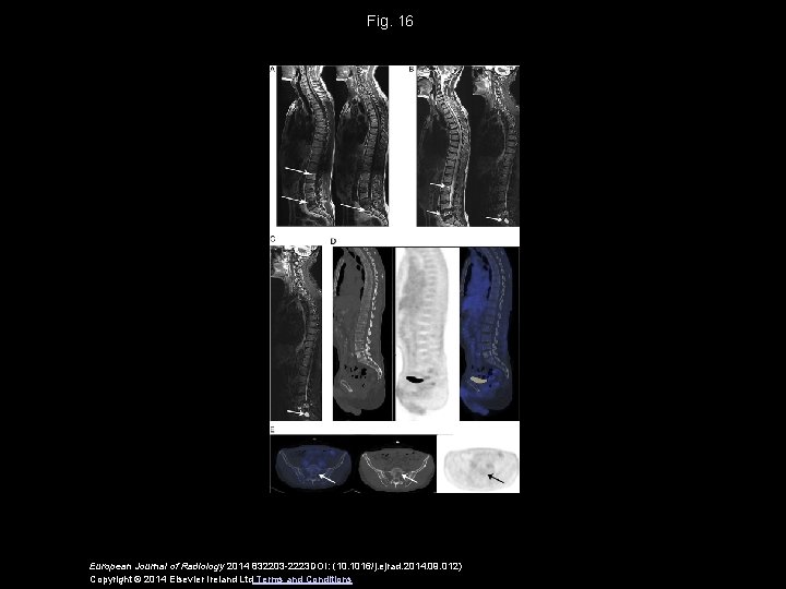 Fig. 16 European Journal of Radiology 2014 832203 -2223 DOI: (10. 1016/j. ejrad. 2014.