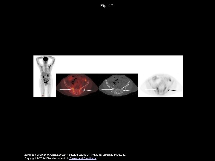 Fig. 17 European Journal of Radiology 2014 832203 -2223 DOI: (10. 1016/j. ejrad. 2014.