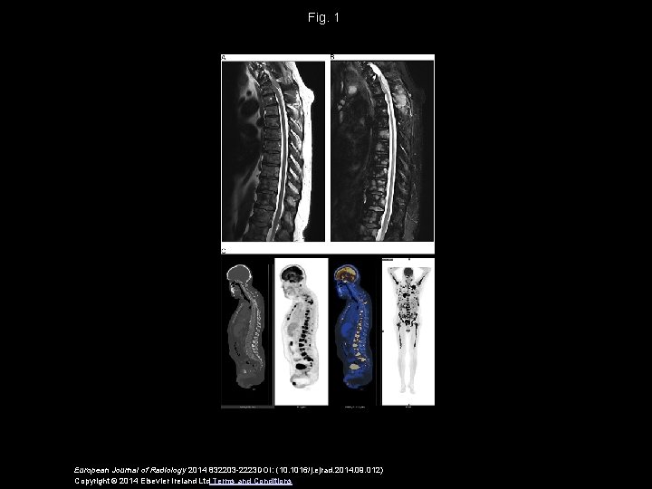 Fig. 1 European Journal of Radiology 2014 832203 -2223 DOI: (10. 1016/j. ejrad. 2014.