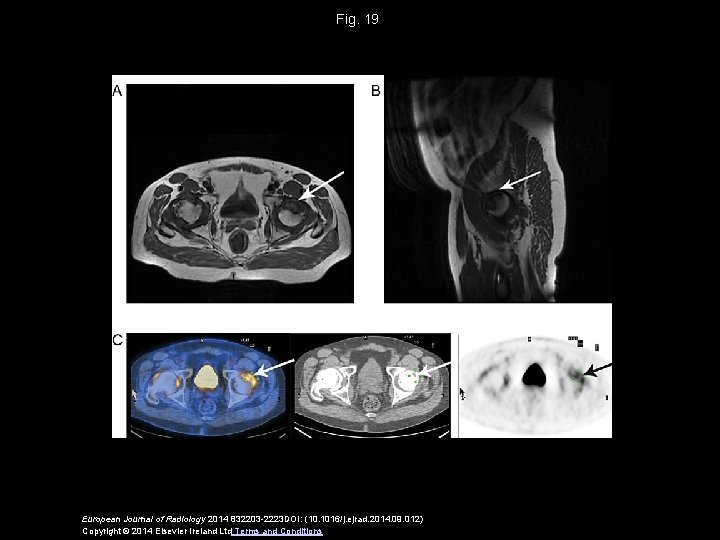 Fig. 19 European Journal of Radiology 2014 832203 -2223 DOI: (10. 1016/j. ejrad. 2014.