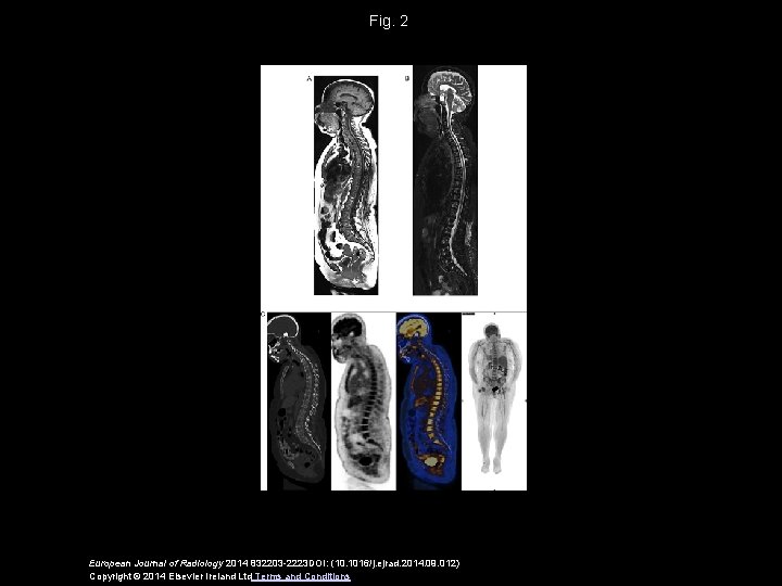 Fig. 2 European Journal of Radiology 2014 832203 -2223 DOI: (10. 1016/j. ejrad. 2014.