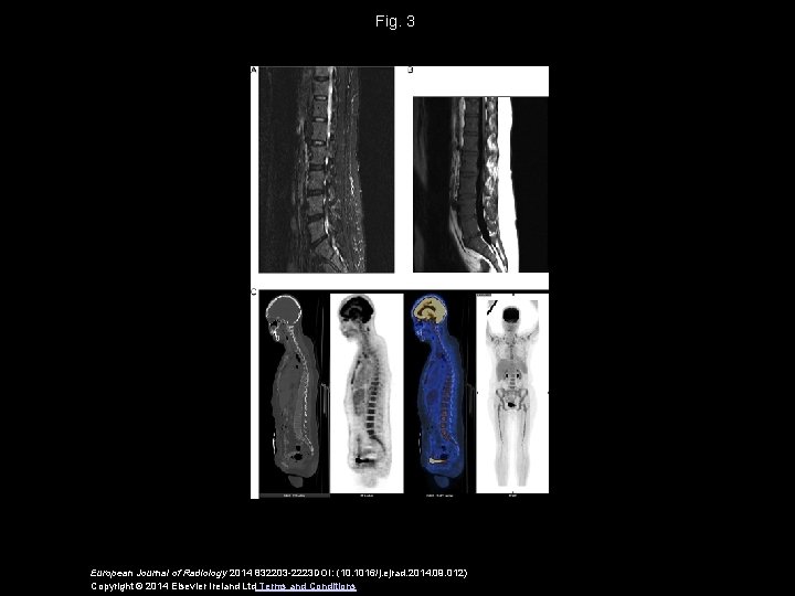 Fig. 3 European Journal of Radiology 2014 832203 -2223 DOI: (10. 1016/j. ejrad. 2014.