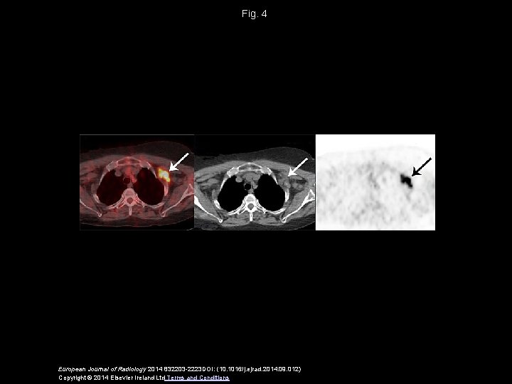 Fig. 4 European Journal of Radiology 2014 832203 -2223 DOI: (10. 1016/j. ejrad. 2014.