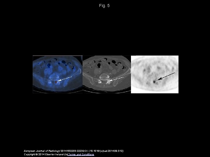 Fig. 5 European Journal of Radiology 2014 832203 -2223 DOI: (10. 1016/j. ejrad. 2014.