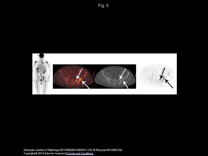 Fig. 6 European Journal of Radiology 2014 832203 -2223 DOI: (10. 1016/j. ejrad. 2014.