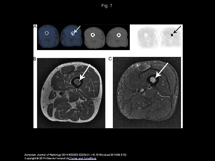 Fig. 7 European Journal of Radiology 2014 832203 -2223 DOI: (10. 1016/j. ejrad. 2014.