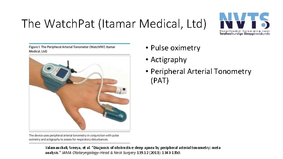 The Watch. Pat (Itamar Medical, Ltd) • Pulse oximetry • Actigraphy • Peripheral Arterial The Watch. Pat (Itamar Medical, Ltd) • Pulse oximetry • Actigraphy • Peripheral Arterial