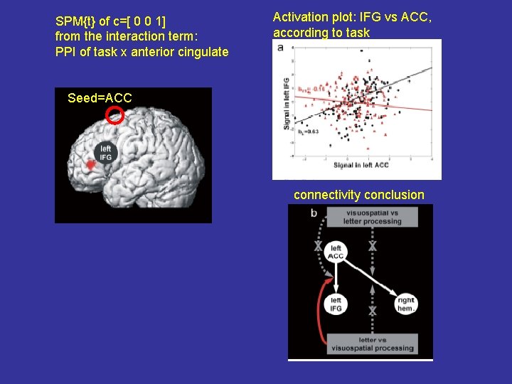 SPM{t} of c=[ 0 0 1] from the interaction term: PPI of task x
