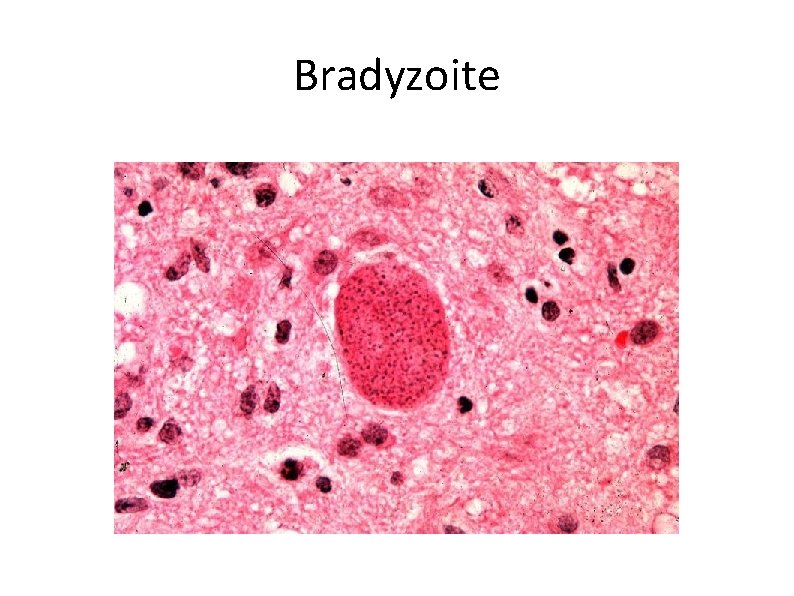 Bradyzoite 