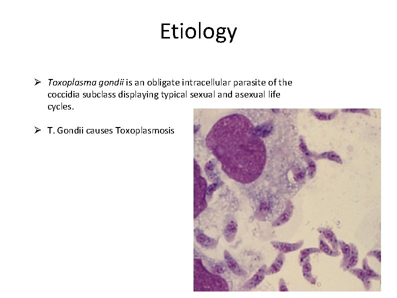 Etiology Ø Toxoplasma gondii is an obligate intracellular parasite of the coccidia subclass displaying