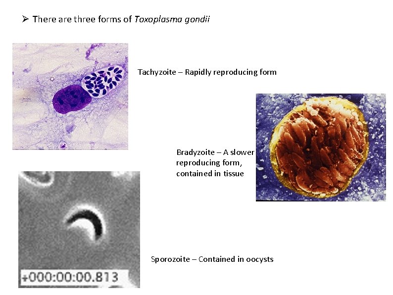 Ø There are three forms of Toxoplasma gondii Tachyzoite – Rapidly reproducing form Bradyzoite