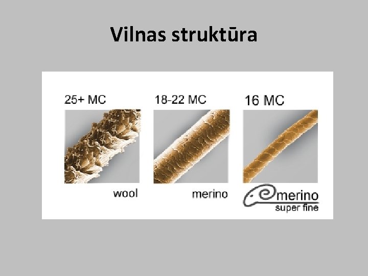 Vilnas struktūra 