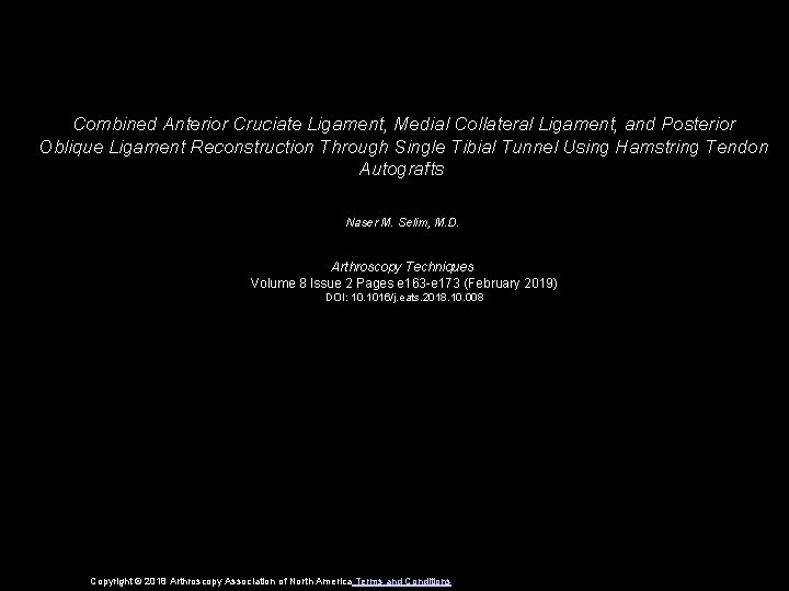 Combined Anterior Cruciate Ligament, Medial Collateral Ligament, and Posterior Oblique Ligament Reconstruction Through Single