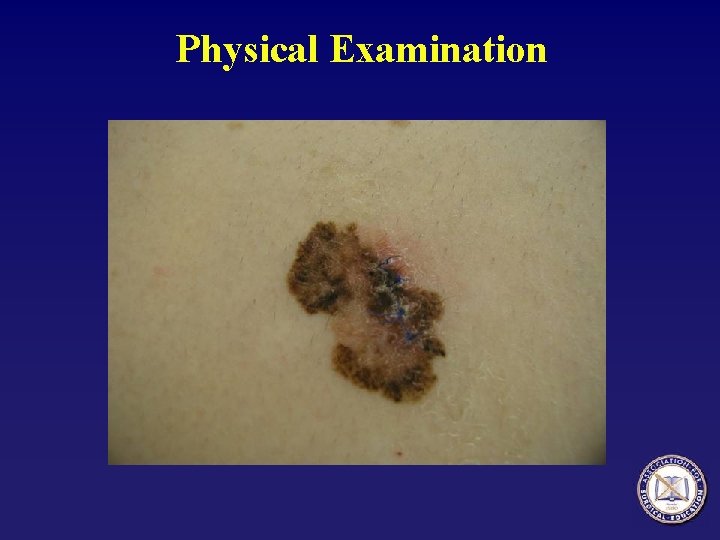 Physical Examination 