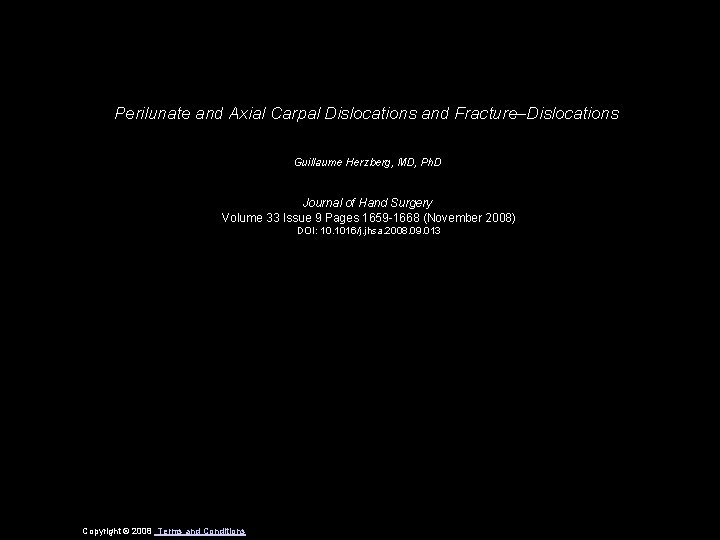 Perilunate and Axial Carpal Dislocations and Fracture–Dislocations Guillaume Herzberg, MD, Ph. D Journal of