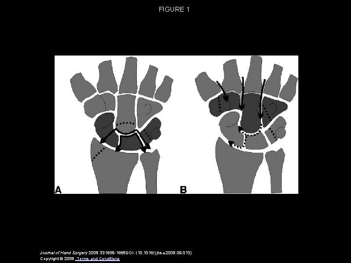 FIGURE 1 Journal of Hand Surgery 2008 331659 -1668 DOI: (10. 1016/j. jhsa. 2008.