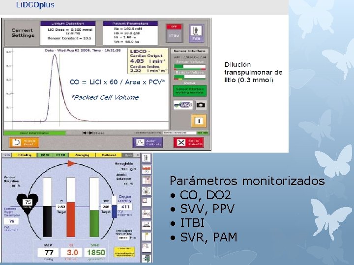 Parámetros monitorizados • CO, DO 2 • SVV, PPV • ITBI • SVR, PAM