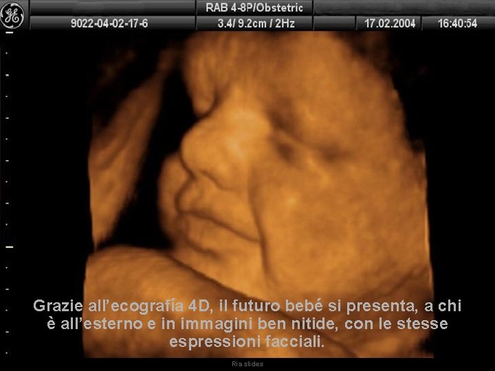 Grazie all’ecografía 4 D, il futuro bebé si presenta, a chi è all’esterno e