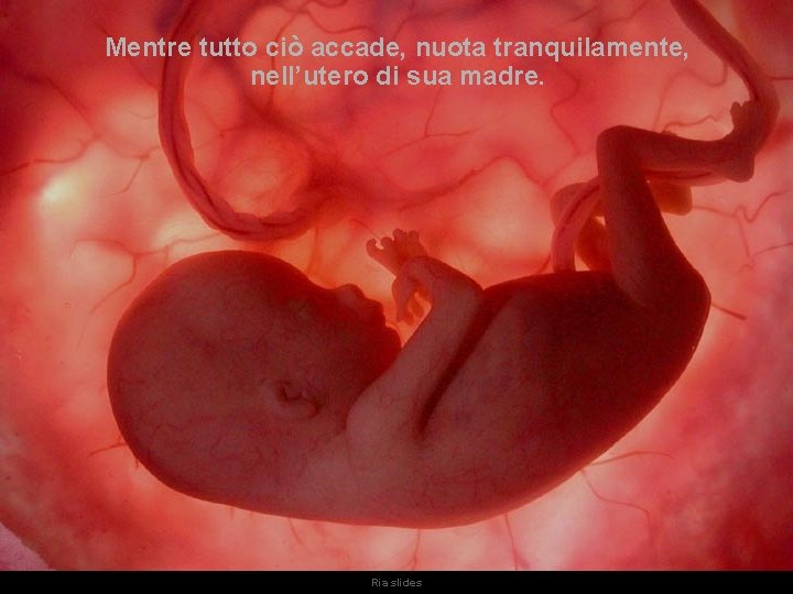 Mentre tutto ciò accade, nuota tranquilamente, nell’utero di sua madre. Ria slides 