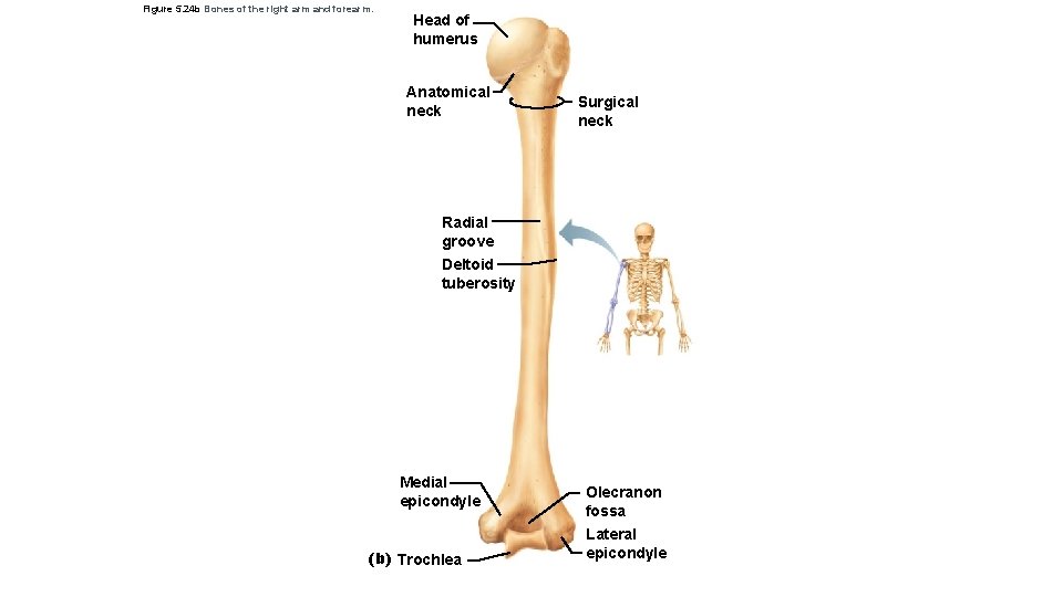 Figure 5. 24 b Bones of the right arm and forearm. Head of humerus