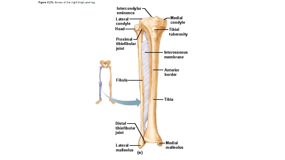 Figure 5. 27 c Bones of the right thigh and leg. Intercondylar eminence Medial