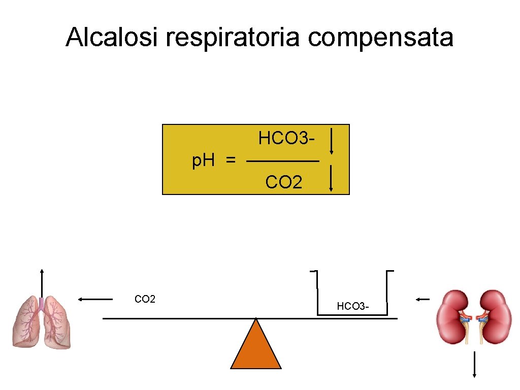 Alcalosi respiratoria compensata HCO 3 p. H = ———— CO 2 HCO 3 -