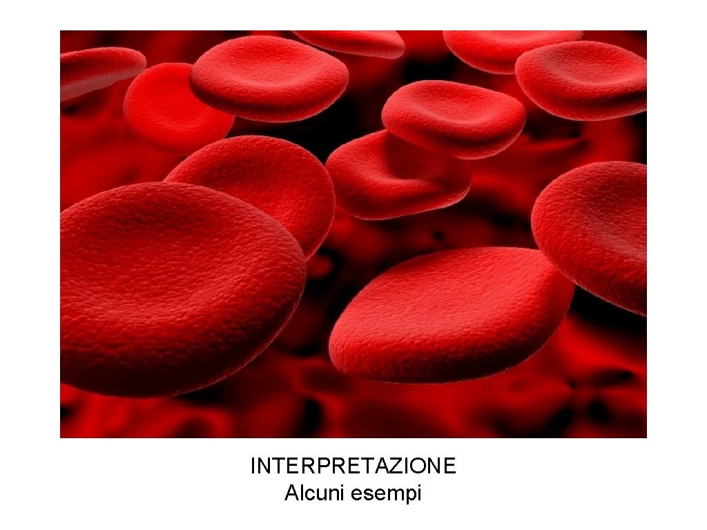 INTERPRETAZIONE Alcuni esempi 