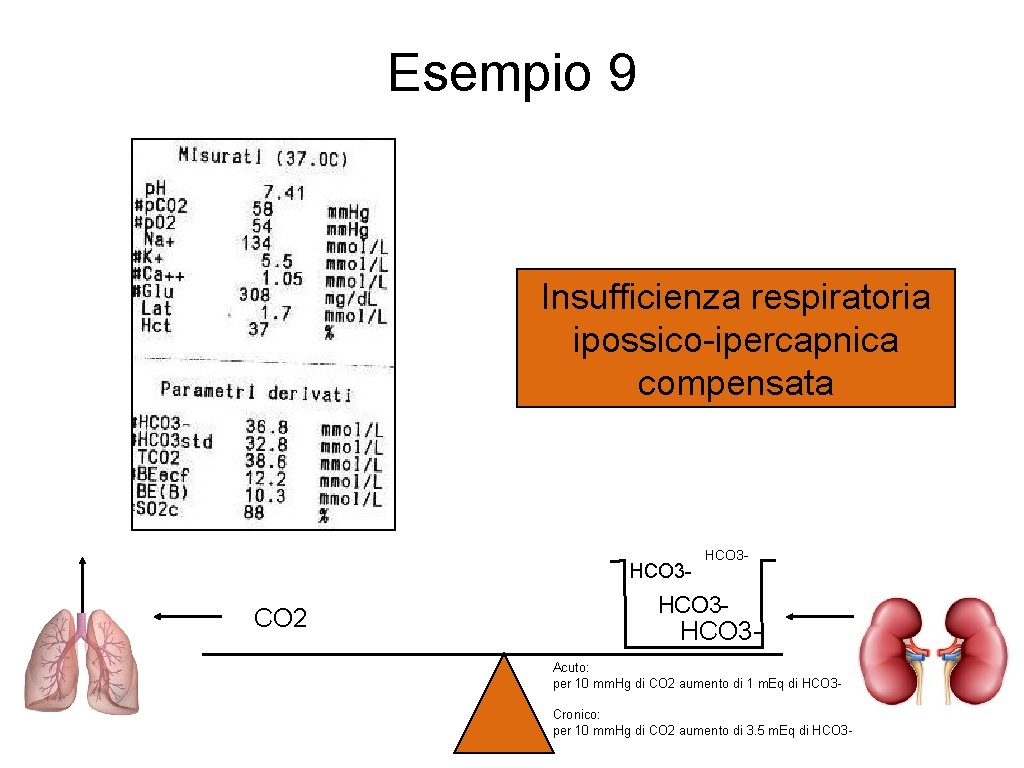 Esempio 9 Insufficienza respiratoria ipossico-ipercapnica compensata HCO 3 - CO 2 HCO 3 -