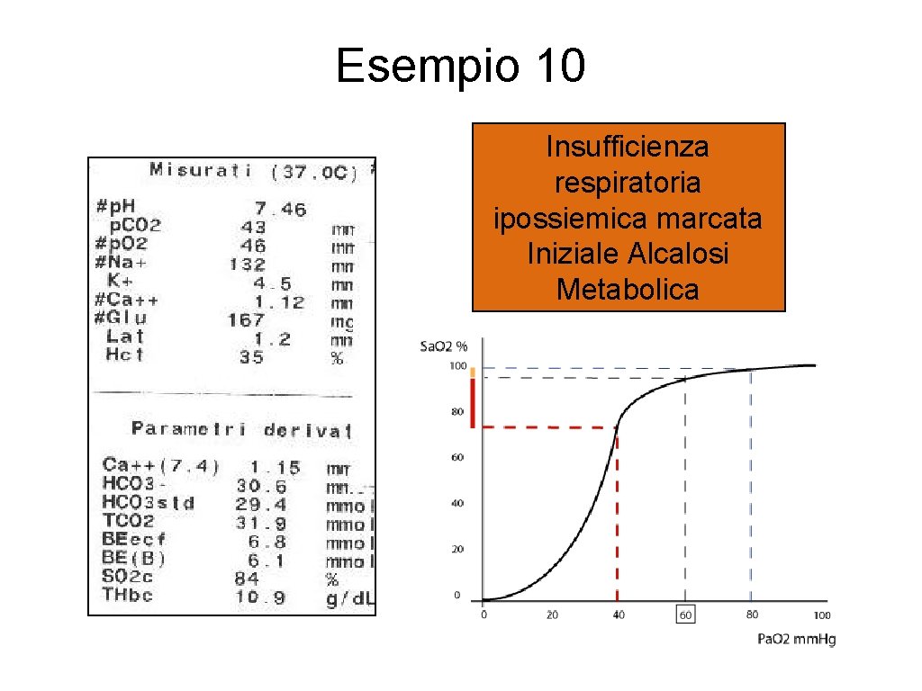 Esempio 10 Insufficienza respiratoria ipossiemica marcata Iniziale Alcalosi Metabolica 