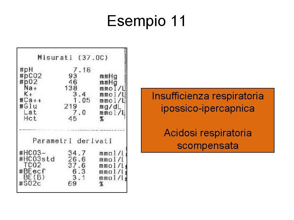 Esempio 11 Insufficienza respiratoria ipossico-ipercapnica Acidosi respiratoria scompensata 