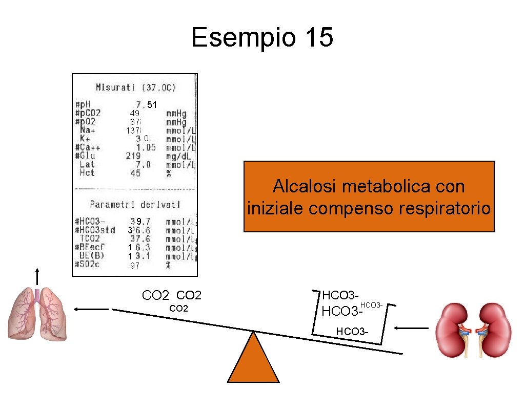 Esempio 15 49 87 137 3 51 . 0 Alcalosi metabolica con iniziale compenso