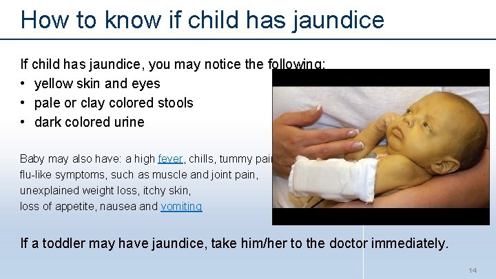 How to know if child has jaundice If child has jaundice, you may notice