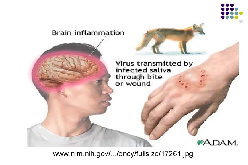 www. nlm. nih. gov/. . . /ency/fullsize/17261. jpg www. nlm. nih. gov/. . . /ency/fullsize/17261. jpg